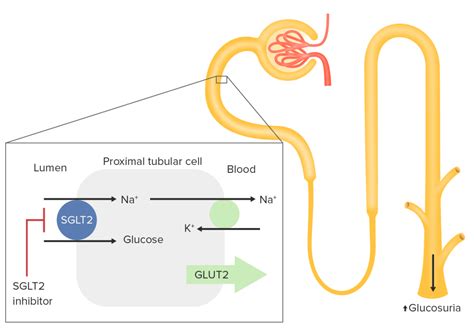 Esquema de la reabsorción de glucosa en el túbulo renal, destacando el papel de SGLT2.