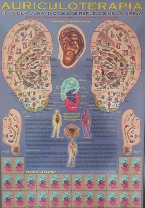 Ilustración de diferentes métodos de aplicación de la auriculoterapia (semillas, imanes, agujas)