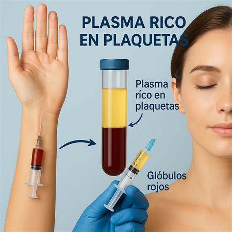 Infografía detallando el proceso de obtención y aplicación del Plasma Rico en Plaquetas