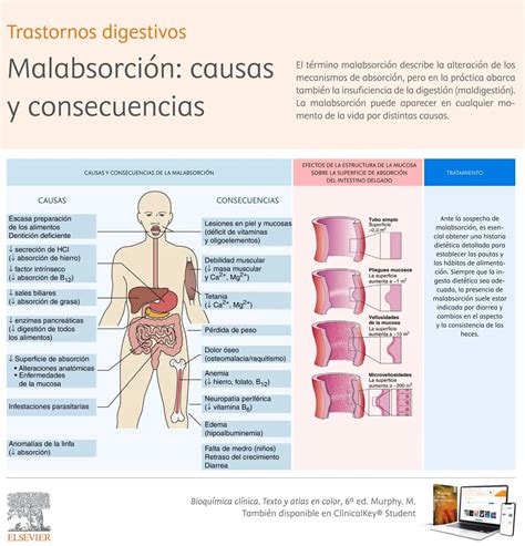 Infografía detallando los síntomas y causas de la malabsorción de carbohidratos