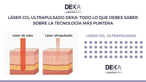 Imagen de la tecnología láser DEKA utilizada en tratamientos de lipoláser