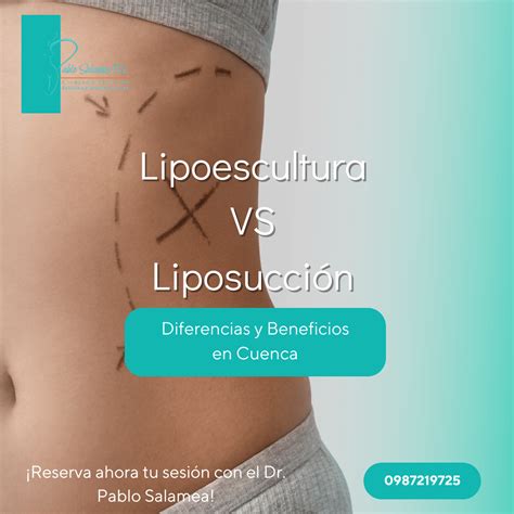 Infografía comparativa entre liposucción y lipoescultura, destacando sus diferencias y objetivos principales.