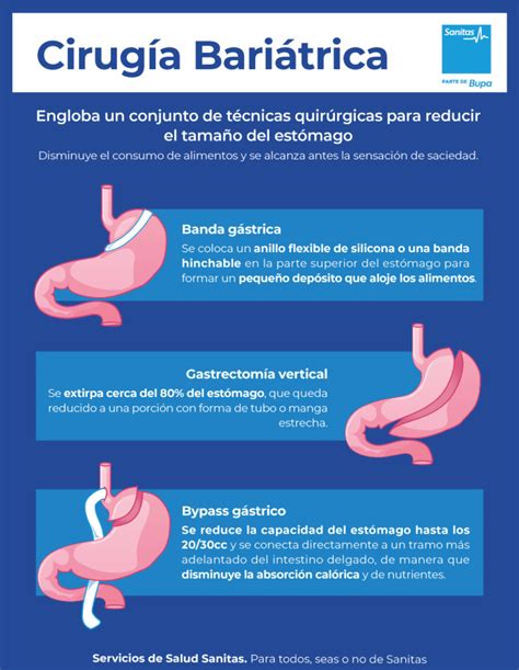 Infografía comparativa de diferentes tipos de cirugía bariátrica y sus implicaciones nutricionales.