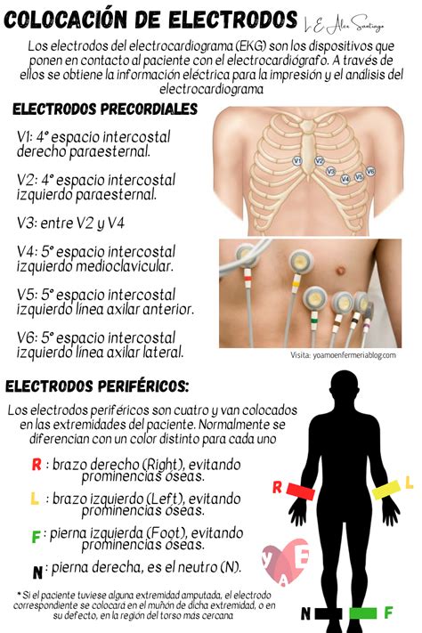 Ilustración detallada de la colocación de electrodos en diferentes zonas del cuerpo: glúteos, piernas y abdomen.