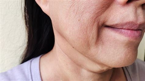 Ilustración mostrando las zonas del rostro y cuerpo afectadas por la flacidez debido al envejecimiento.