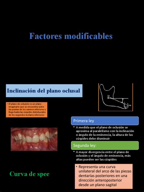 Infografía mostrando los factores modificables e inmodificables que afectan la flexibilidad.