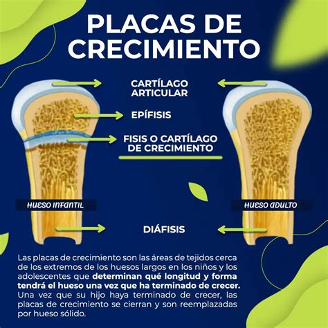 diagrama que ilustra los huesos y placas de crecimiento, mostrando cómo el exceso de peso puede afectarlos.