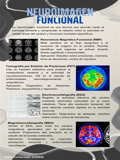 infografía con iconos representando diferentes técnicas de neuroimagen y sus aplicaciones en neonatología