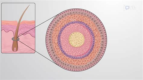 Microfotografía de un folículo piloso sano comparado con uno debilitado por una dieta alta en grasas.