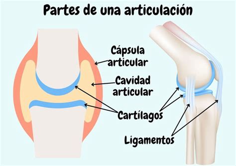 Diagrama de una articulación sana y una articulación con artritis, mostrando el cartílago desgastado.