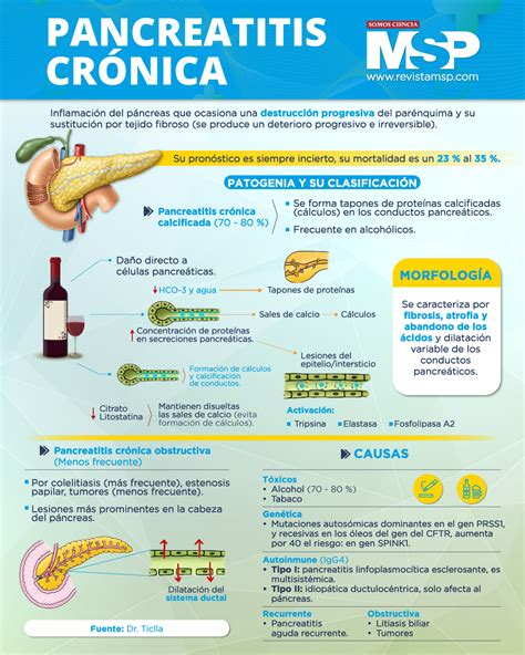 Infografía mostrando los síntomas comunes de la pancreatitis crónica: dolor abdominal, esteatorrea, pérdida de peso.