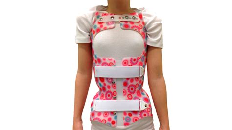 Diseño de un corsé ortopédico para la escoliosis, mostrando su estructura flexible y correas de ajuste.