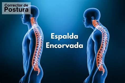 Ilustración mostrando la postura correcta y la postura encorvada, con una flecha indicando cómo la faja de corrección postural ayuda.