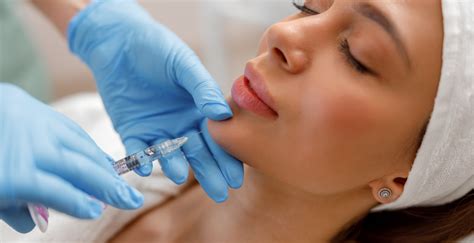 Diagrama que muestra la aplicación de ácido hialurónico para rellenar arrugas y perfilar labios.