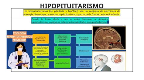 Diagrama que ilustra las posibles causas del hipopituitarismo.