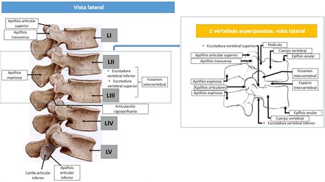 Infografía: Anatomía de la columna lumbar y puntos de apoyo de una faja.