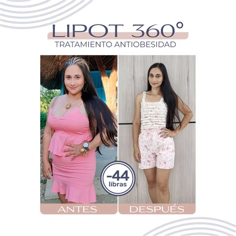 Infografía detallando las áreas tratadas por la Lipo 360 y los beneficios clave.