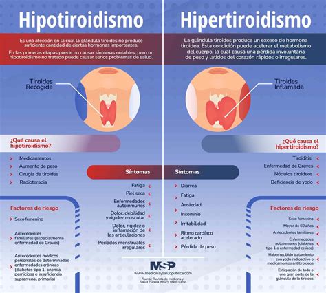 infografía detallando los síntomas comunes de hipotiroidismo e hipertiroidismo