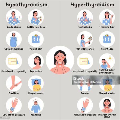 gráfico comparativo mostrando la tasa metabólica en personas con tiroides normal, hipotiroidismo e hipertiroidismo