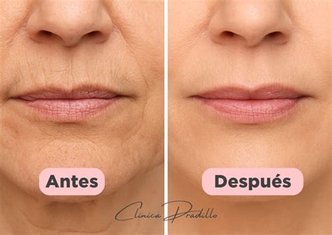 Ilustración comparativa antes y después de tratamientos estéticos para piernas.