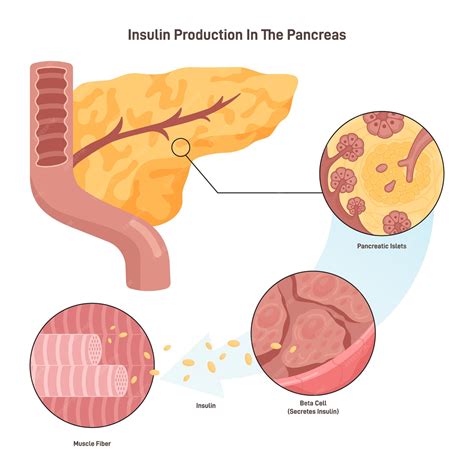 diagrama del páncreas y la producción de insulina