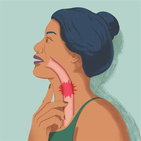 Ilustración de una persona experimentando dificultad para tragar.