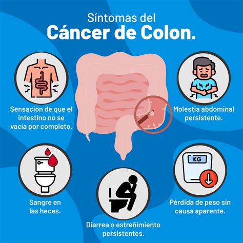 Infografía: Síntomas de alerta del cáncer de intestino
