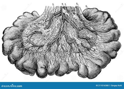 Ilustración anatómica del mesenterio y posibles quistes