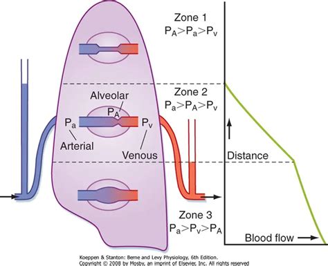 Diagrama de las tres zonas del pulmón, mostrando el efecto de la gravedad en el flujo sanguíneo pulmonar.