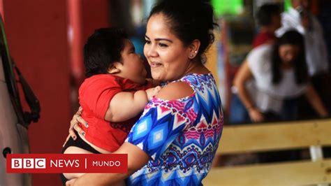 Fotografía de Luis Manuel, el bebé mexicano reconocido como el más obeso del mundo.