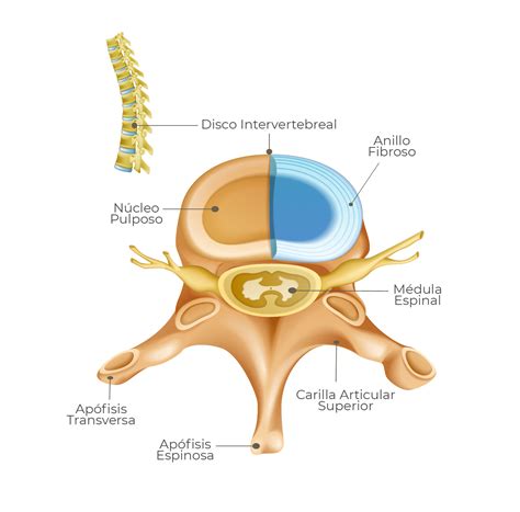 Infografía detallada de la anatomía de la columna vertebral y los discos intervertebrales.