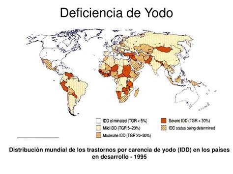 Mapa mundial que muestra la prevalencia de la deficiencia de yodo.