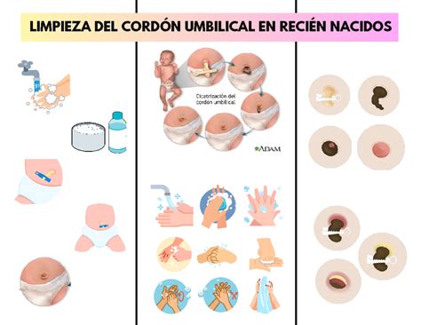 Infografía: Pasos para la limpieza del cordón umbilical en recién nacidos