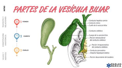 ilustración médica: anatomía de la vesícula biliar y vías biliares con posibles cálculos