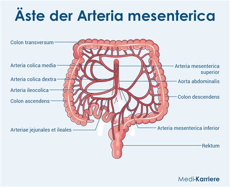 Diagrama anatómico que muestra la arteria mesentérica superior comprimiendo el duodeno.