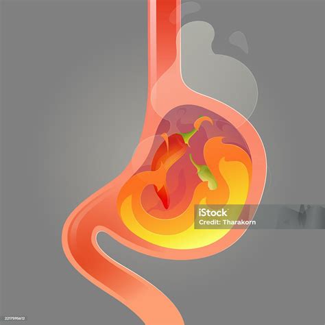 Ilustración de un estómago inflamado y cómo el rábano ayuda a reducirla