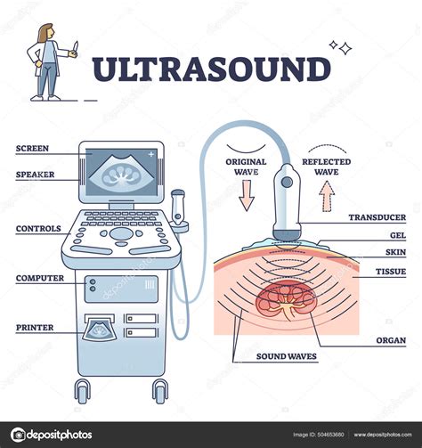 Esquema del dispositivo VASER emitiendo ultrasonidos para emulsionar la grasa.