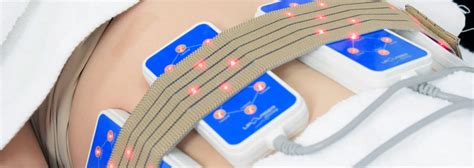 Diagrama ilustrando la aplicación de lipoláser en diferentes zonas del cuerpo