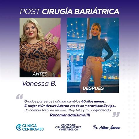 Infografía: Factores que contribuyen al aumento de peso después de la cirugía bariátrica