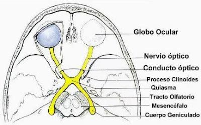 Ilustración del nervio óptico y su relación con la presión intracraneal.