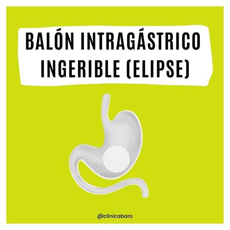 Ilustración de una cápsula de balón intragástrico ingerible Elipse