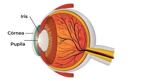 Ilustración anatómica del ojo humano, destacando la córnea y el iris, para explicar el hifema.