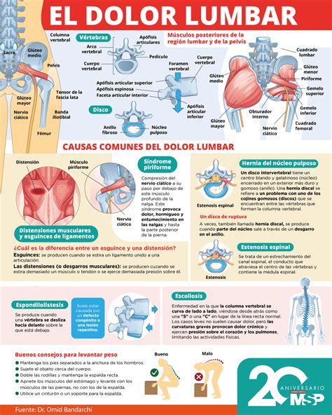 Infografía: Principales causas del dolor lumbar