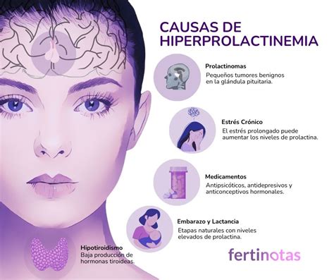 Infografía mostrando los síntomas comunes de la hiperprolactinemia en hombres y mujeres.