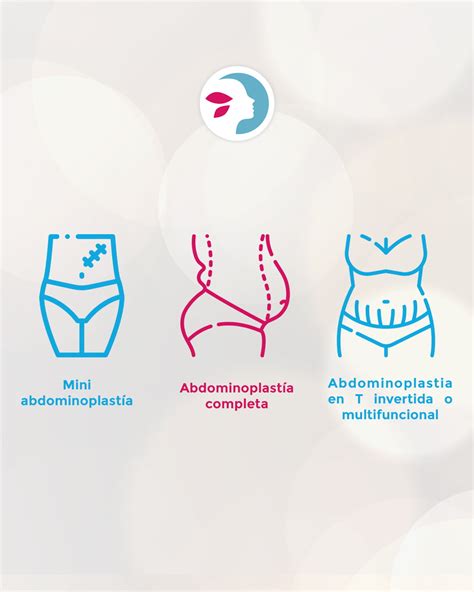 Infografía comparativa de los resultados de la abdominoplastia y la minidermolipectomia.
