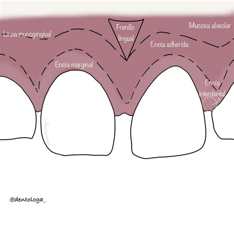 Diagrama que muestra la anatomía bucal, señalando posibles focos de infección: diente, encía, labio.