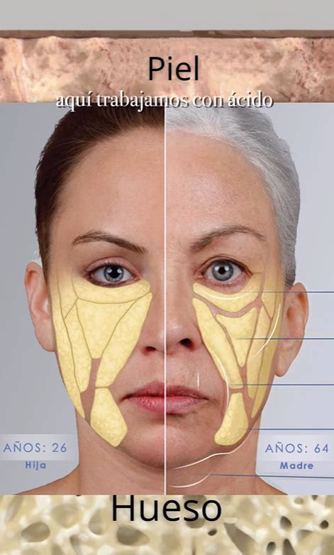 esquema: tratamientos estéticos para la flacidez facial