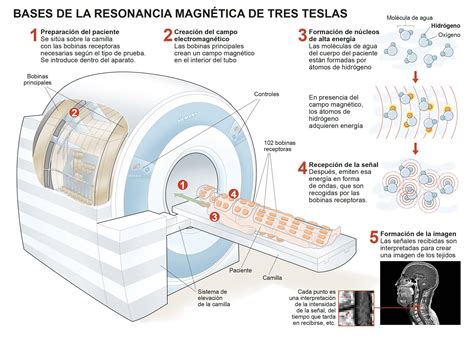 Diagrama explicativo del principio de funcionamiento de la resonancia magnética, mostrando el campo magnético, las ondas de radio y la emisión de señales por los protones del cuerpo.