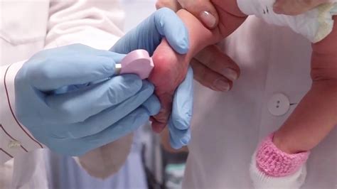 Un recién nacido con la prueba del talón realizada, mostrando la pequeña muestra de sangre recogida del talón.