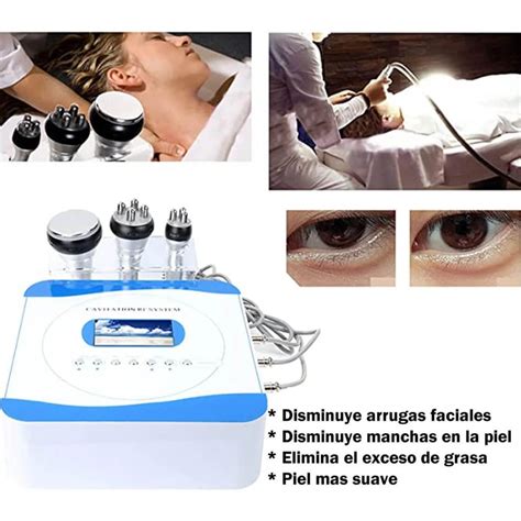 Infografía comparativa de tecnologías de remodelación corporal: HIFU, Cavitación, Radiofrecuencia, Vacumterapia.